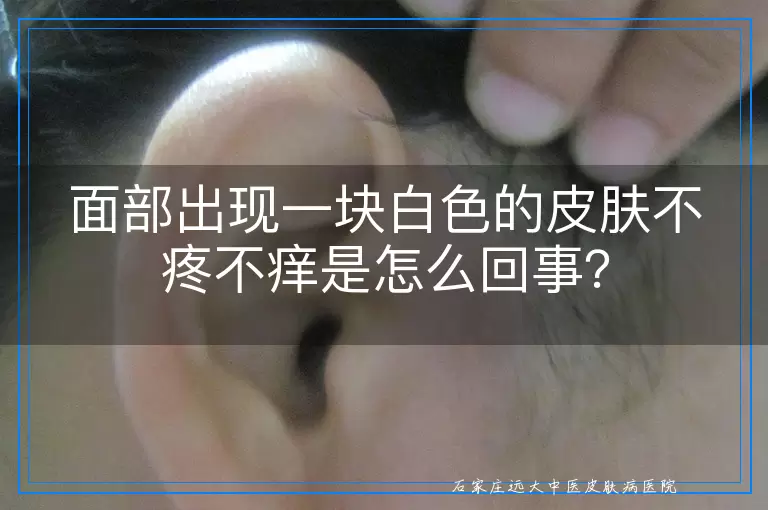面部出现一块白色的皮肤不疼不痒是怎么回事？