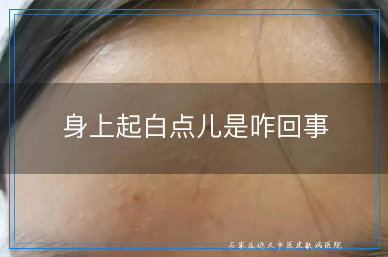 身上起白点儿是咋回事