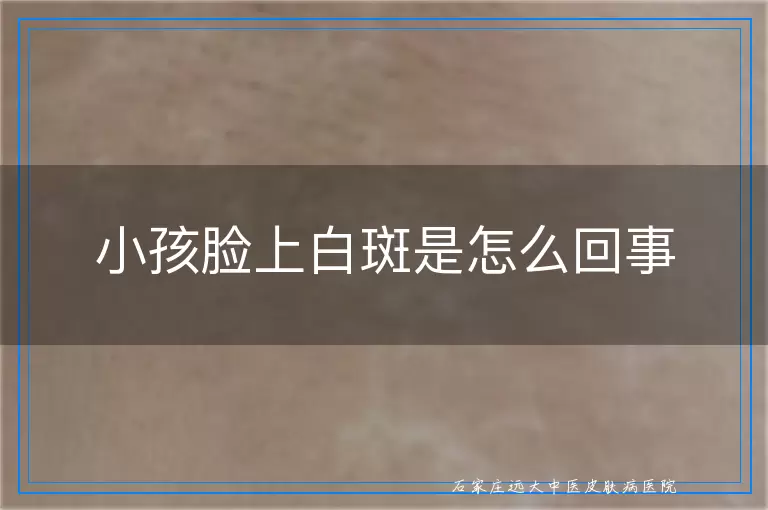 小孩脸上白斑是怎么回事