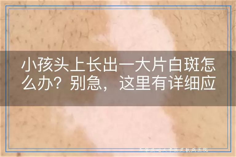 小孩头上长出一大片白斑怎么办？别急，这里有详细应对方法！