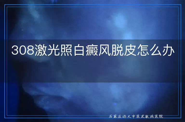 308激光照白癜风脱皮怎么办