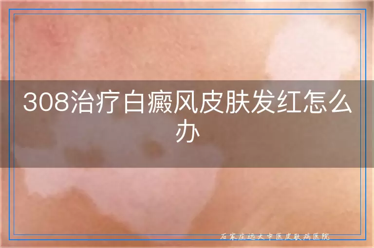 308治疗白癜风皮肤发红怎么办