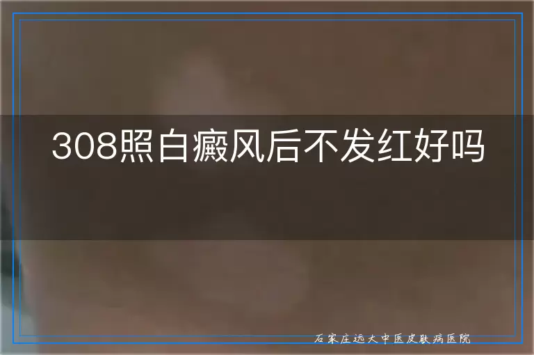 308照白癜风后不发红好吗