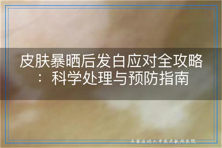 皮肤暴晒后发白应对全攻略：科学处理与预防指南