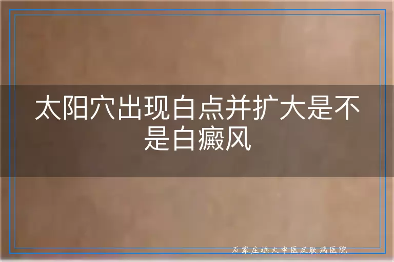 太阳穴出现白点并扩大是不是白癜风