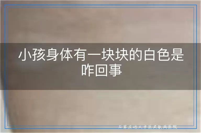小孩身体有一块块的白色是咋回事