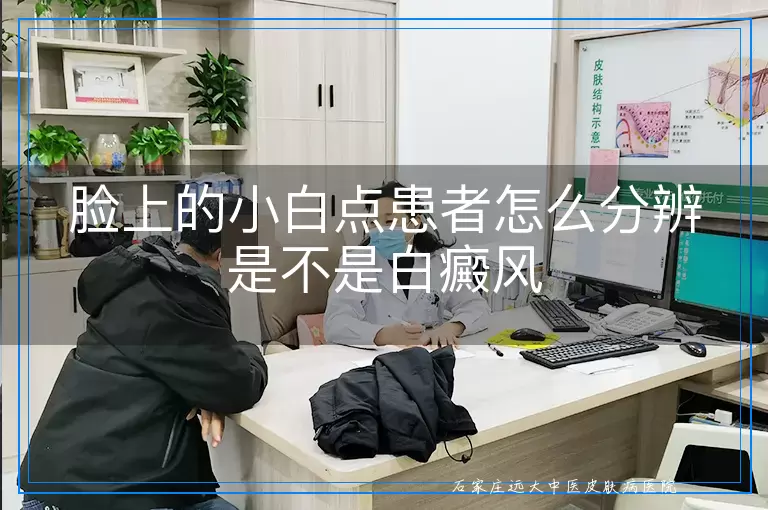 脸上的小白点患者怎么分辨是不是白癜风
