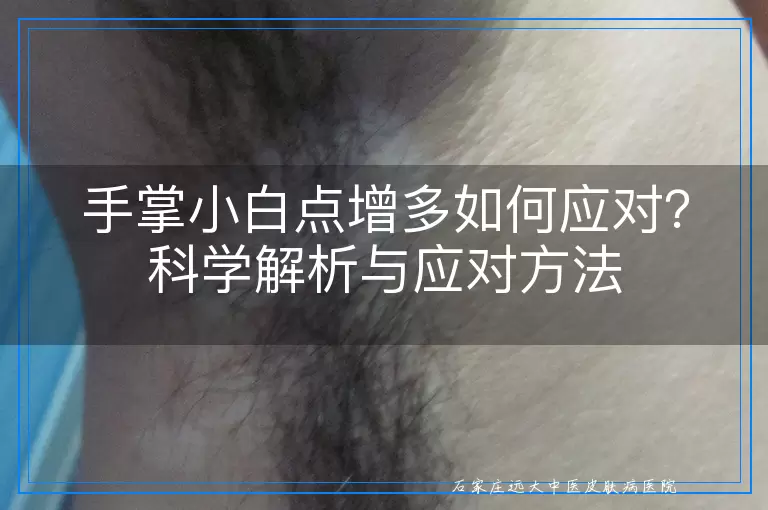 手掌小白点增多如何应对？科学解析与应对方法