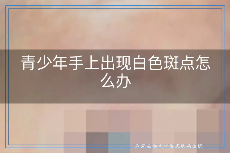 青少年手上出现白色斑点怎么办