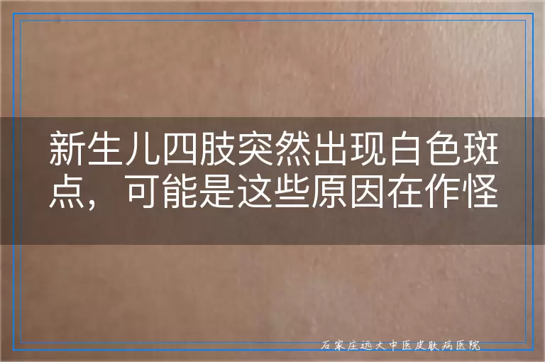 新生儿四肢突然出现白色斑点,可能是这些原因在作怪!
