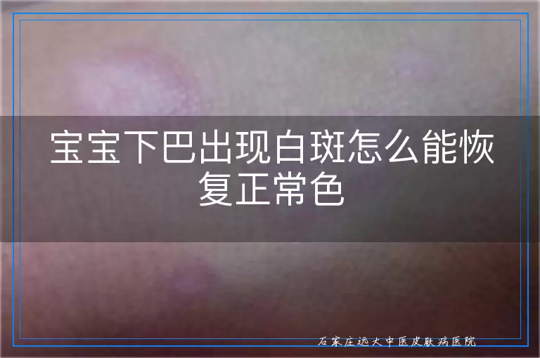 宝宝下巴出现白斑怎么能恢复正常色