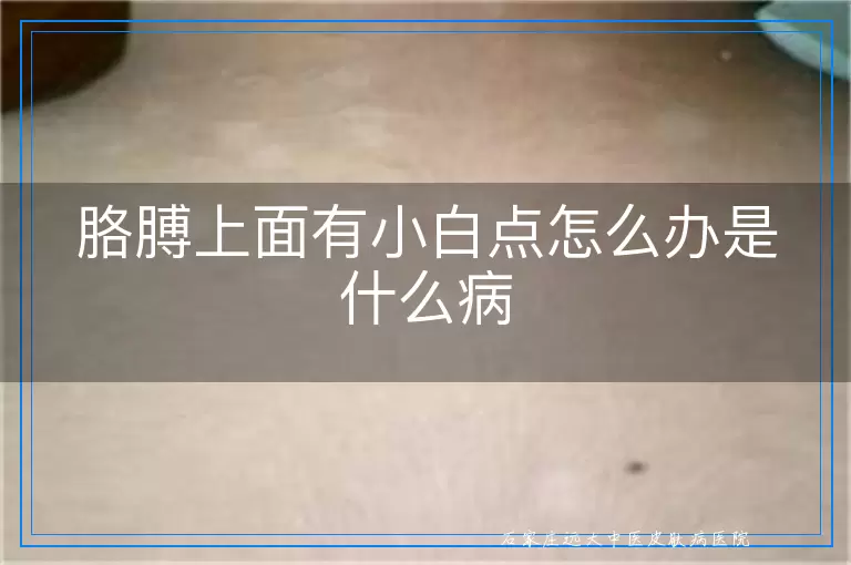 胳膊上面有小白点怎么办是什么病