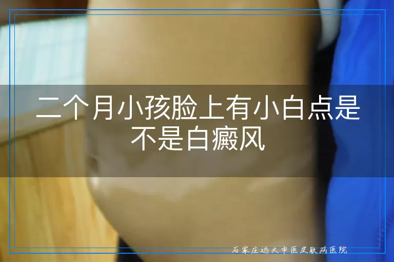 二个月小孩脸上有小白点是不是白癜风