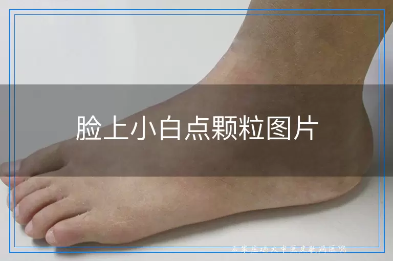 脸上小白点颗粒图片