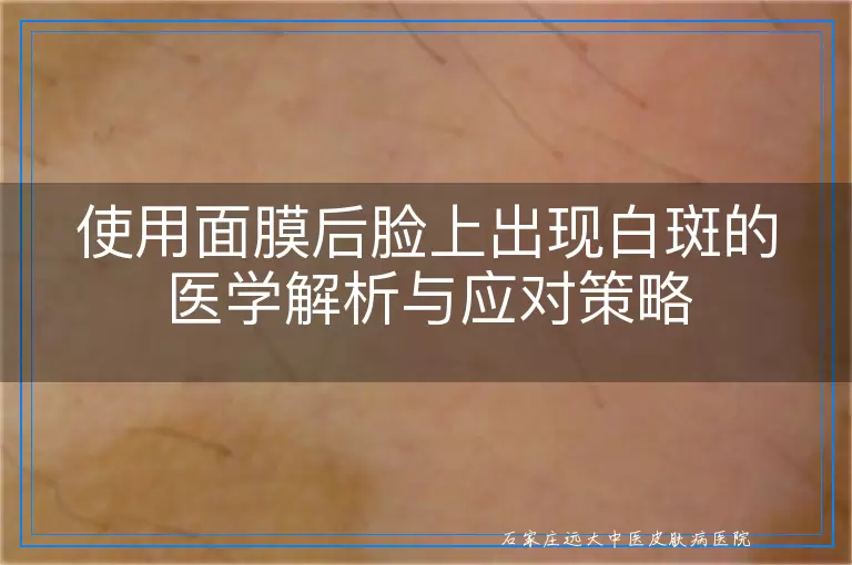 使用面膜后脸上出现白斑的医学解析与应对策略