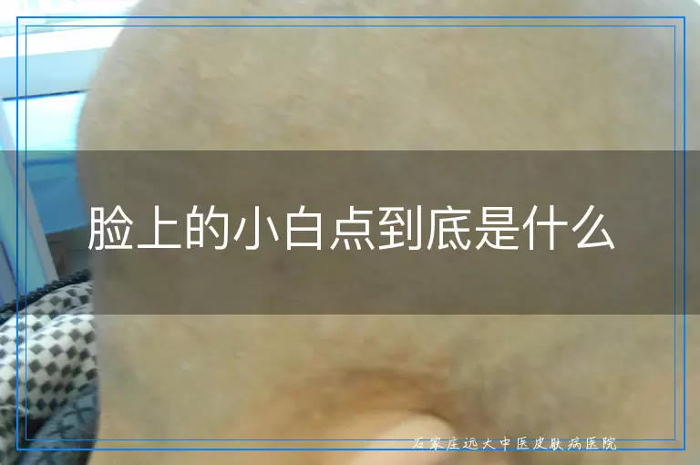 脸上的小白点到底是什么