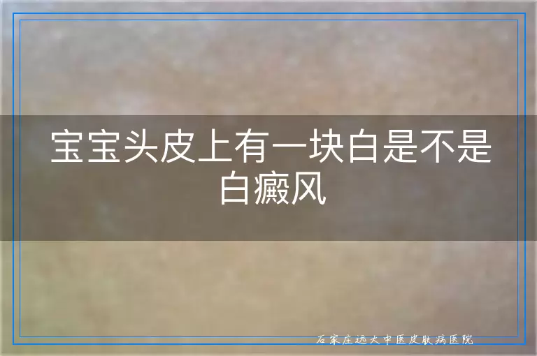 宝宝头皮上有一块白是不是白癜风