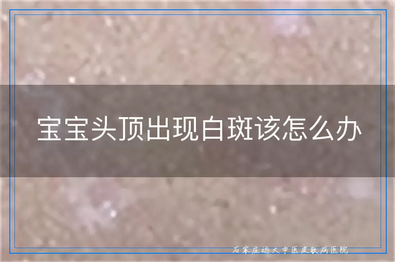 宝宝头顶出现白斑该怎么办
