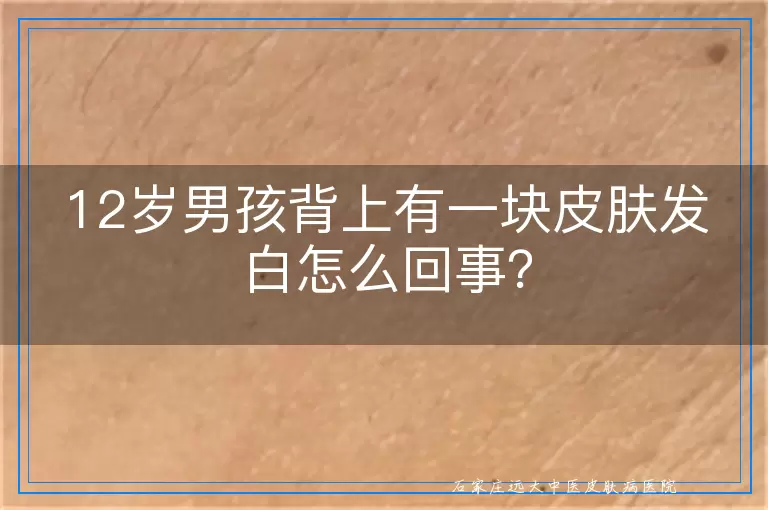 12岁男孩背上有一块皮肤发白怎么回事？