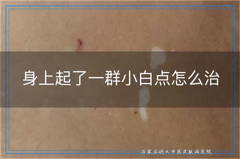 身上起了一群小白点怎么治