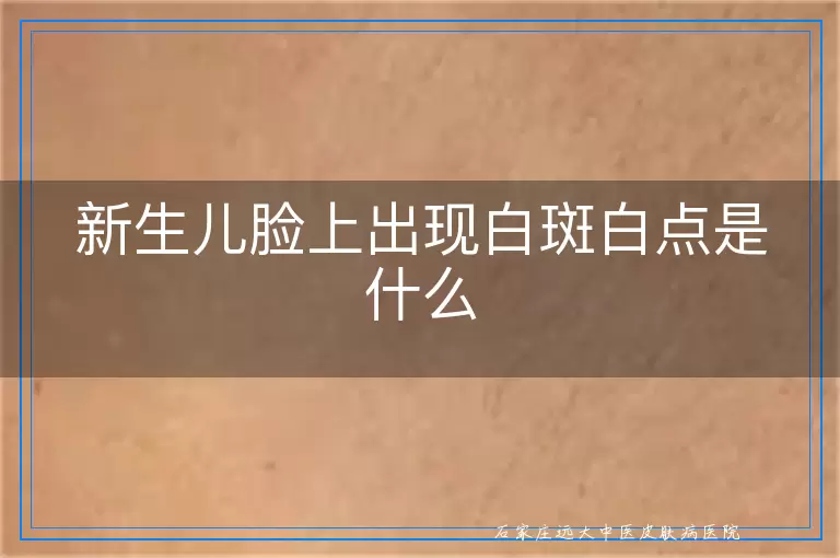 新生儿脸上出现白斑白点是什么