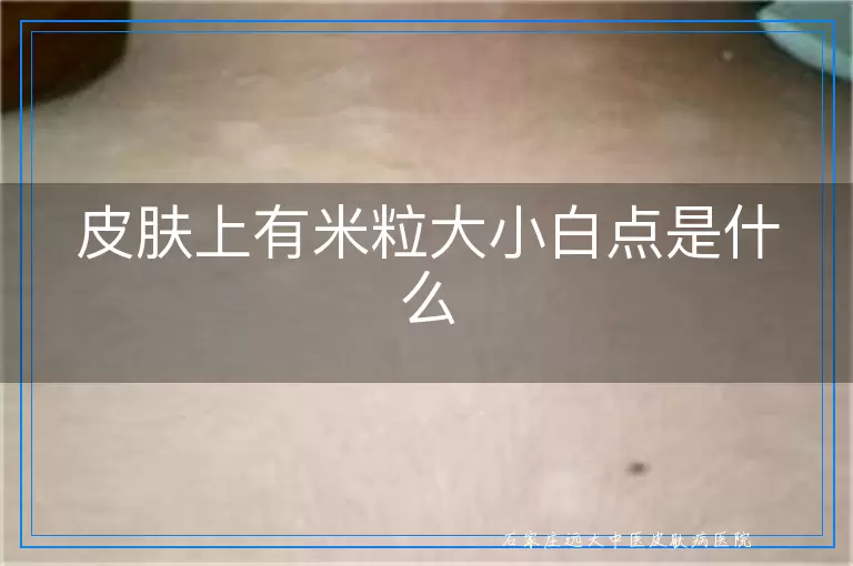 皮肤上有米粒大小白点是什么
