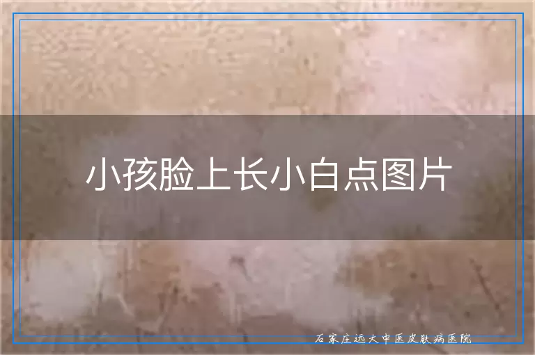 小孩脸上长小白点图片