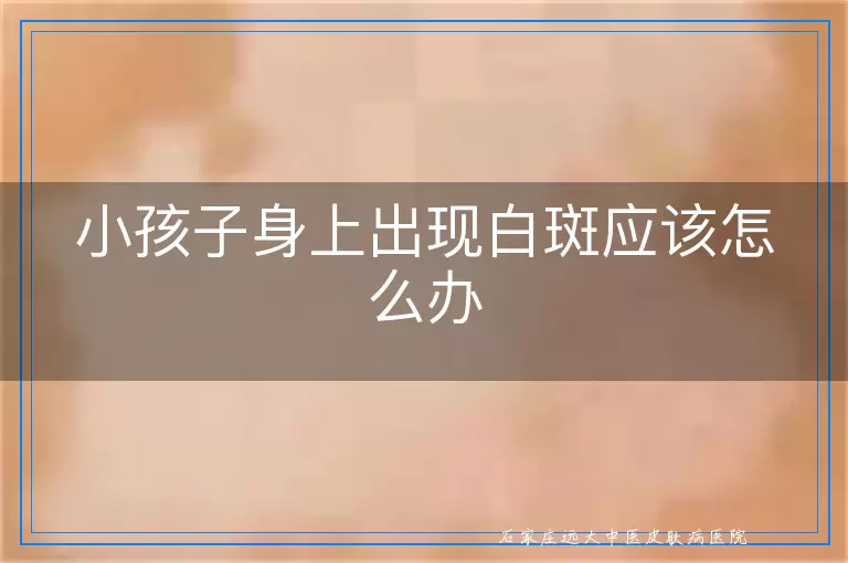 小孩子身上出现白斑应该怎么办