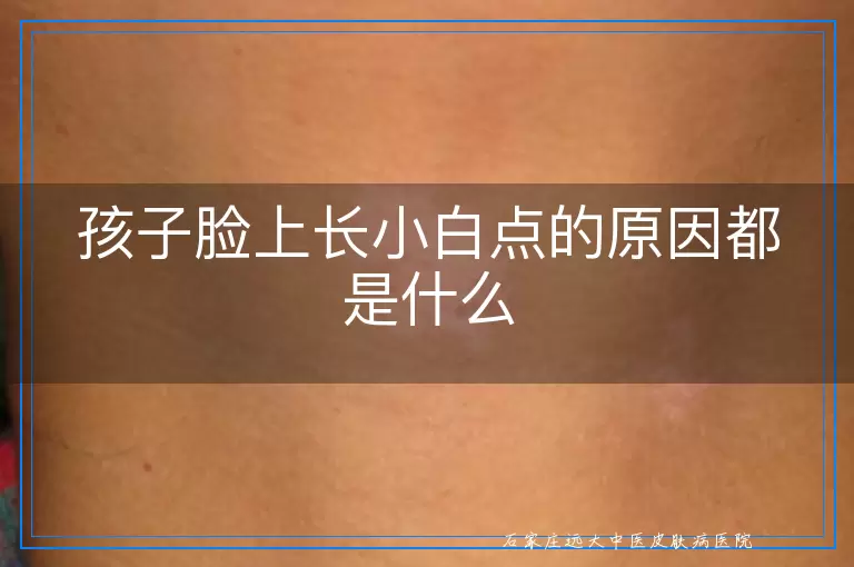 孩子脸上长小白点的原因都是什么