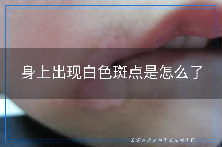 身上出现白色斑点是怎么了