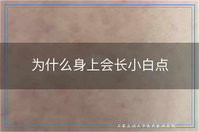 为什么身上会长小白点