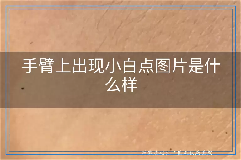 手臂上出现小白点图片是什么样