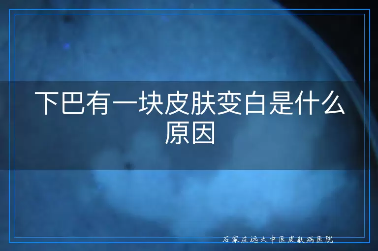 下巴有一块皮肤变白是什么原因