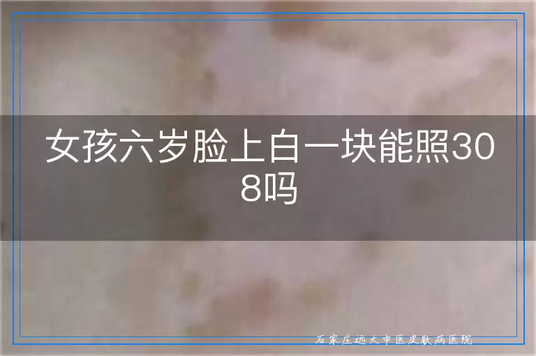 女孩六岁脸上白一块能照308吗