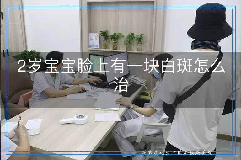 2岁宝宝脸上有一块白斑怎么治