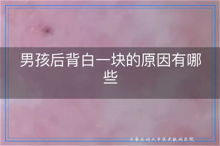 男孩后背白一块的原因有哪些