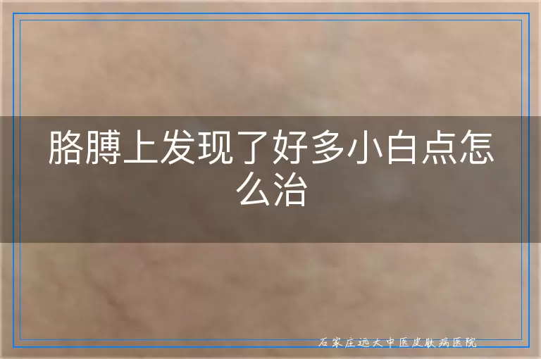 胳膊上发现了好多小白点怎么治
