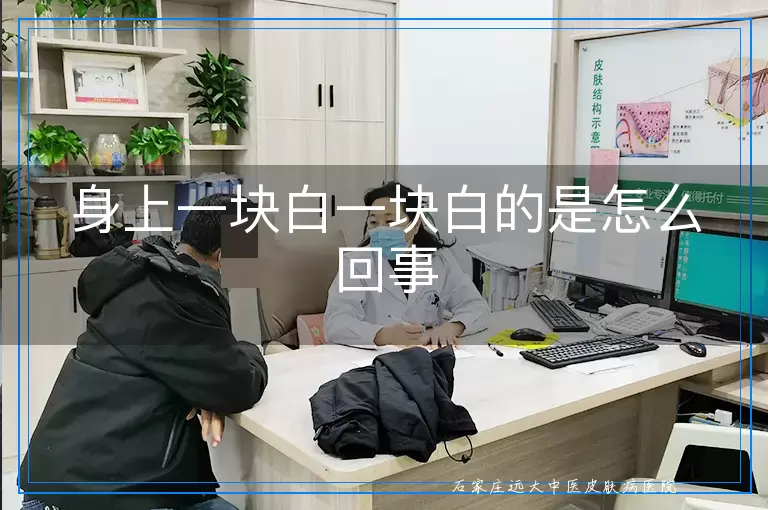 身上一块白一块白的是怎么回事