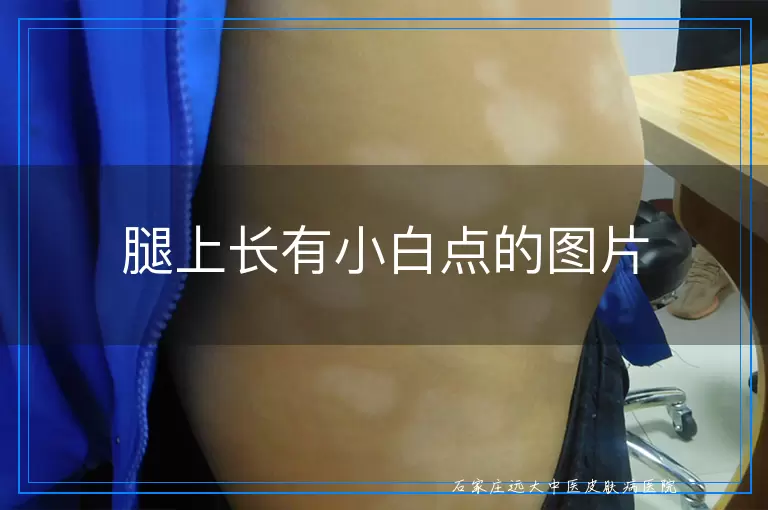 腿上长有小白点的图片