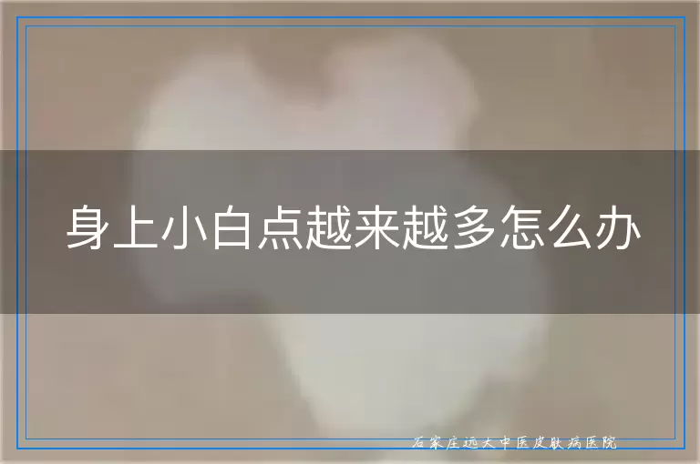 身上小白点越来越多怎么办