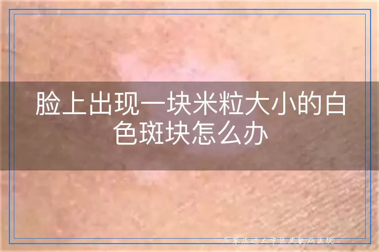 脸上出现一块米粒大小的白色斑块怎么办
