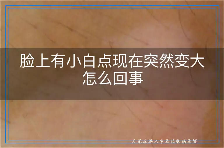 脸上有小白点现在突然变大怎么回事