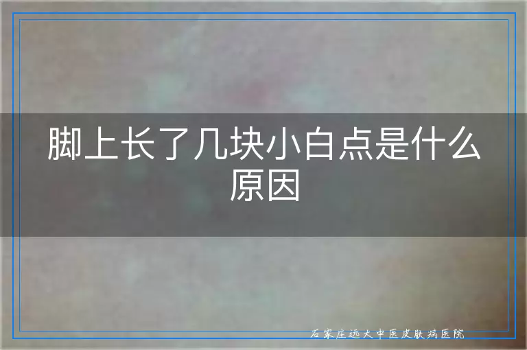 脚上长了几块小白点是什么原因