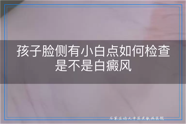 孩子脸侧有小白点如何检查是不是白癜风