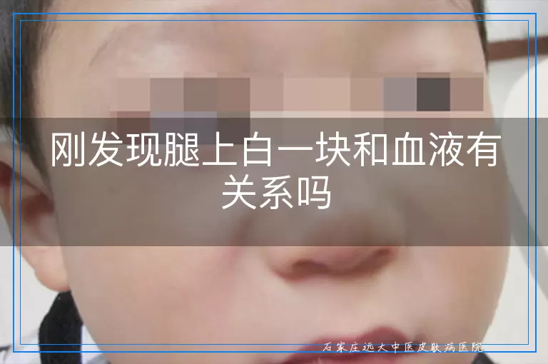 刚发现腿上白一块和血液有关系吗