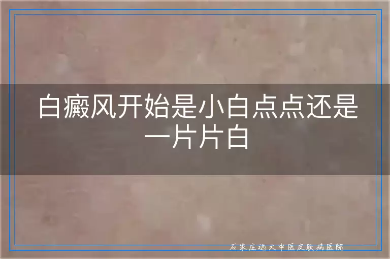 白癜风开始是小白点点还是一片片白