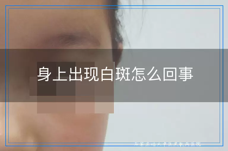 身上出现白斑怎么回事