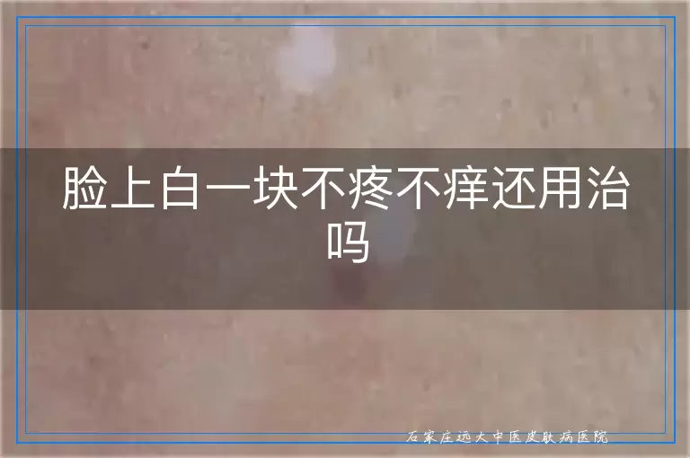 脸上白一块不疼不痒还用治吗