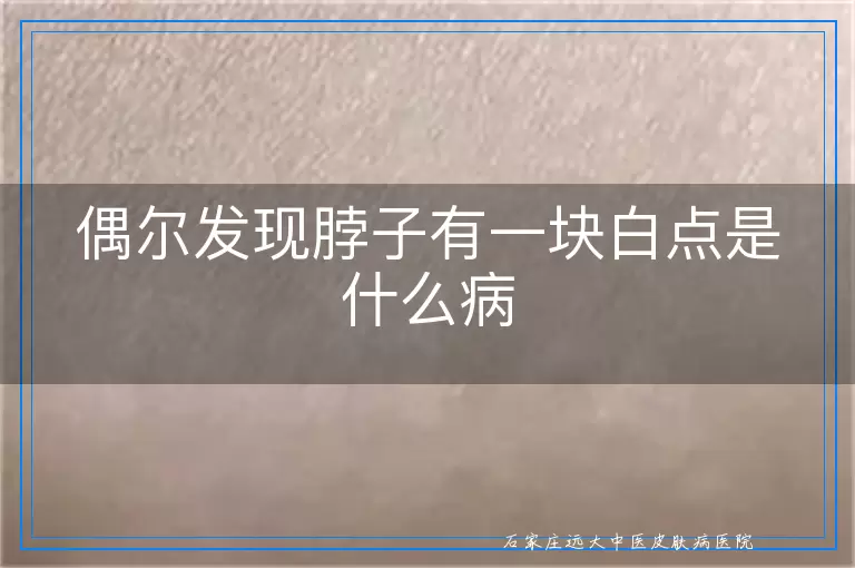 偶尔发现脖子有一块白点是什么病