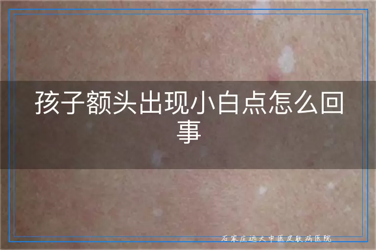 孩子额头出现小白点怎么回事